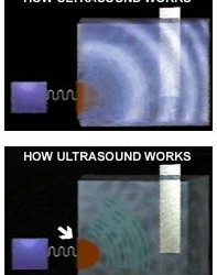 ultrasound