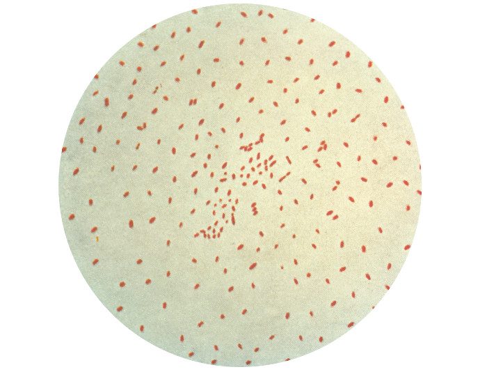 Microscopic image of Bordetella pertussis bacteria using Gram staining technique.