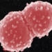 viable deinococcus radiodurans the only organism that can withstand high radiation 8942