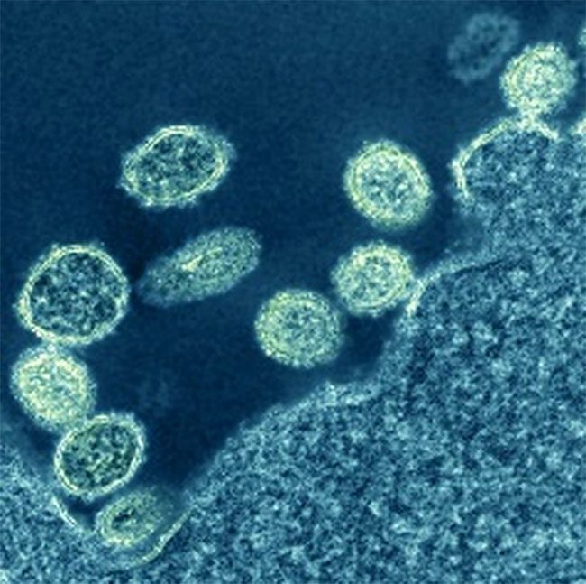 H1N1 virus particles near a cell, under microscope in 1918