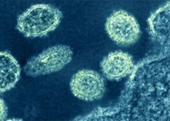 virus outbreak may have caused mysterious epidemic in 1977 136664