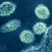 virus outbreak may have caused mysterious epidemic in 1977 136664