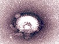 virus VSDT