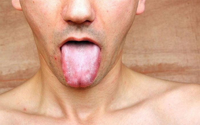 Syphilis can manifest in the mouth area.