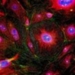 biological sensors help early detection of cancer 2526