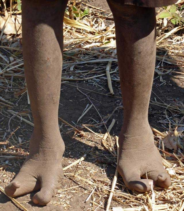 Many people are curious about why the feet of the Vadoma tribe are like this.