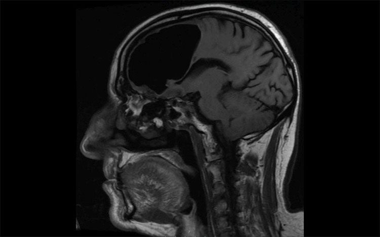 MRI scan image.