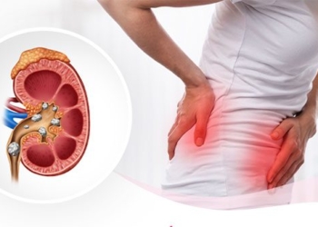 common causes of urinary bladder irritation you should know 135889