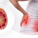 common causes of urinary bladder irritation you should know 135889