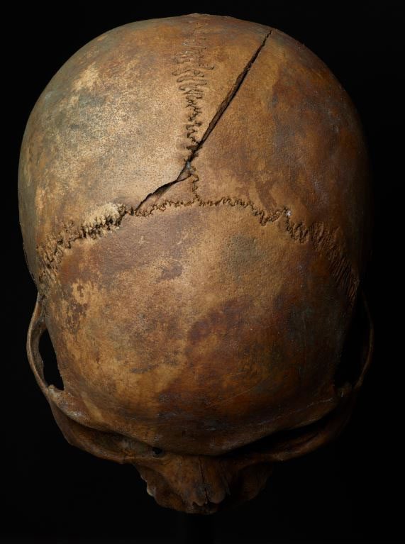 Many fracture marks on the skull indicate the victims suffered a horrific death