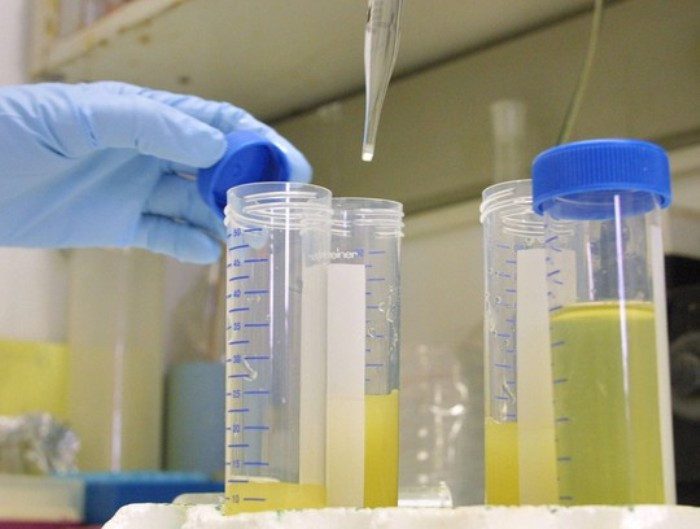 Clear Yellow Urine is fine; it likely means you have consumed a lot of water at once