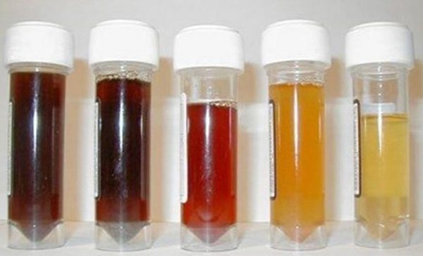 Urine Color Can Indicate What's Happening in Your Body