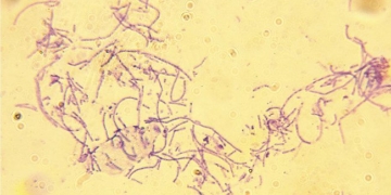 microbial weapon biological danger 89814