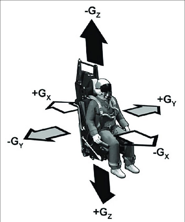 Other less serious effects of G-force include musculoskeletal pain.