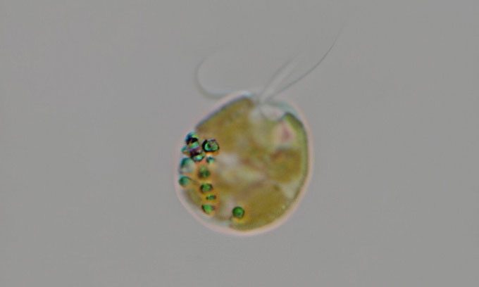 A golden algae cell (Prymnesium parvum).