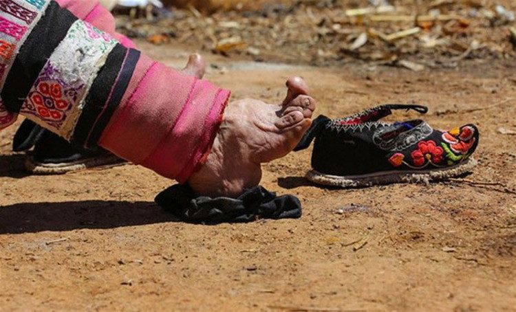 The lotus feet of a Chinese woman after her shoes.