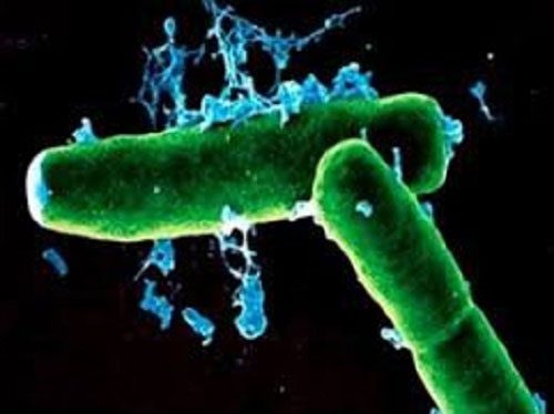 Bacteria can transmit anthrax from animals to humans.