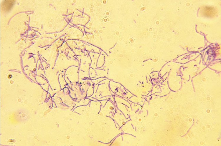 Anthrax bacteria are rod-shaped.