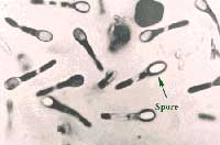 vikhuan clostridium