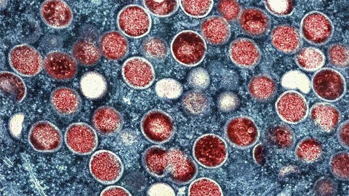 Monkeypox viruses found inside an infected cell.