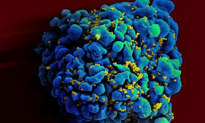 Image showing HIV virus entering T cells (immune cells).