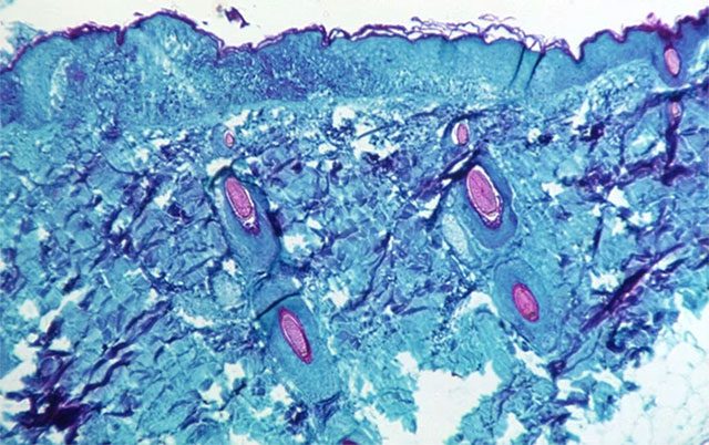 Monkeypox virus entering cells.