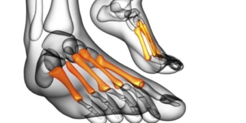 why asian people have only 204 bones while europeans and americans have up to 206 bones 118351