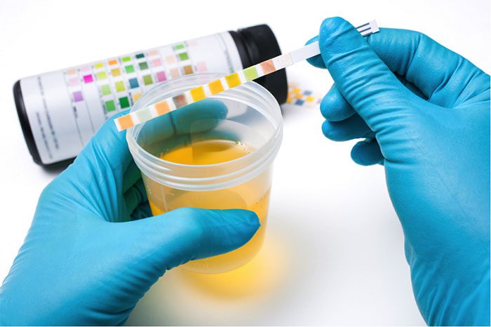 The most commonly applied urine test.