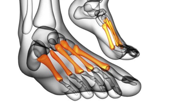 The number of bones in humans is not "static," nor fixed.