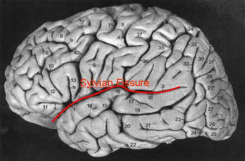 What did scientists do with Albert Einstein's brain after his death?