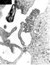Dengue Virus seen through an electron microscope