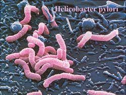 H. pylori Bacteria