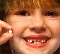 after teeth kids 5067