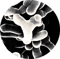 Bifidobacteria