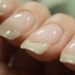 bone loss disease discovered through finger 4632