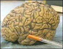brain