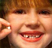 Children with early tooth decay are at risk for future dental issues
