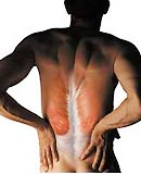 To treat back pain, you cannot rely solely on medication; you also need to combine it with exercise