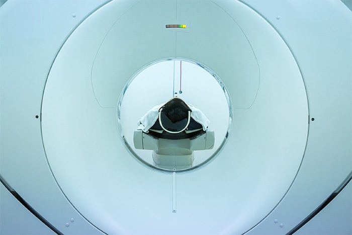 The process of performing a PET CT scan is safe yet not overly complicated.