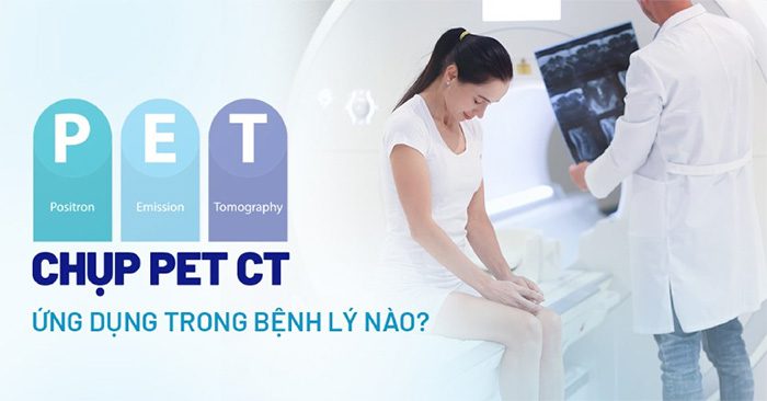 chup pet ct