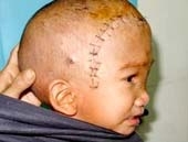 free education for poor children 4850