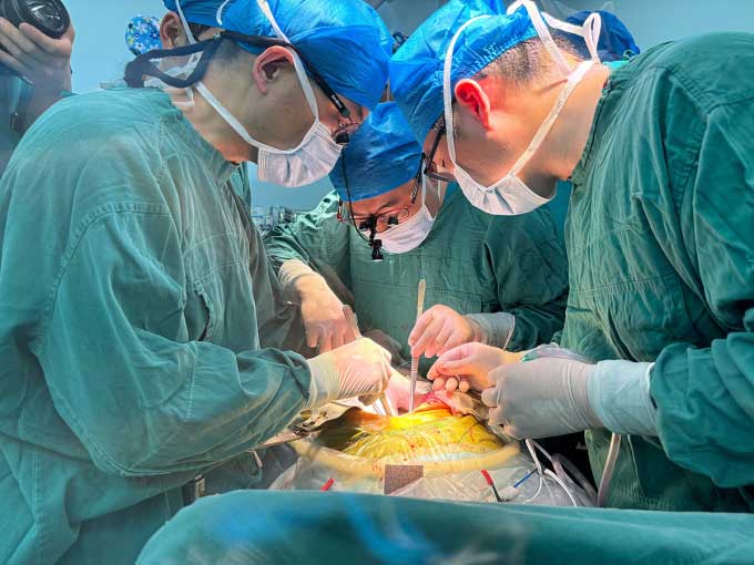 Surgeons transplanting pig liver into a 71-year-old patient at the First Affiliated Hospital on May 17.