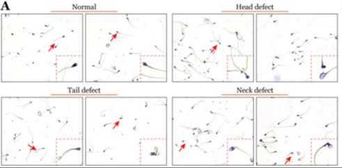 Identifying sperm defects while swimming alongside microplastic particles.