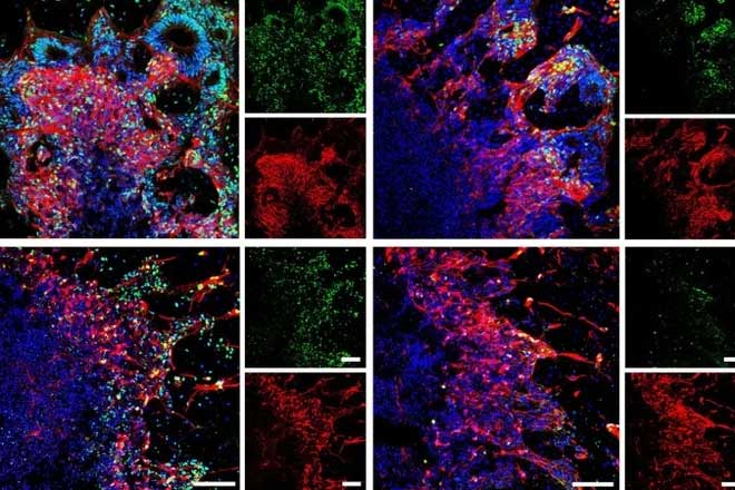 Thawed brain tissues illustrated through immunofluorescence staining technique (IF).