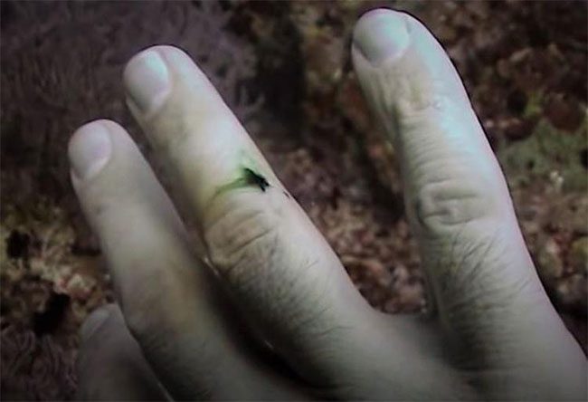 Green blood of a diver bitten by a Moray eel