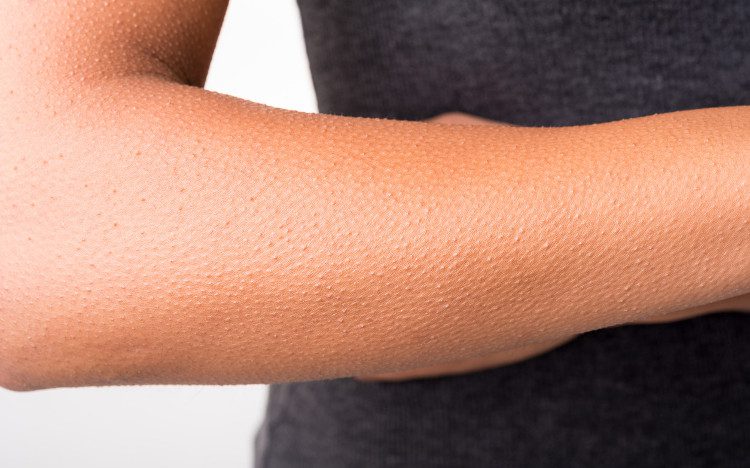 Goosebumps usually occur when we feel cold (to protect body temperature), fear, excitement, and many other emotions.