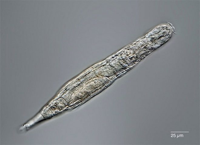 Magnified image of the 24,000-year-old rotifer found in Siberia