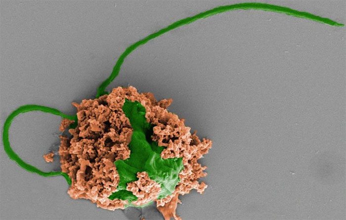 Microalgae robot aids in lung cancer treatment