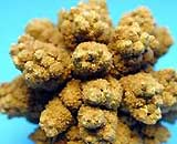 Bladder Stones