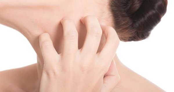 Reduce Itching